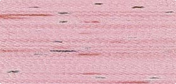 Bild folgt in Kürze